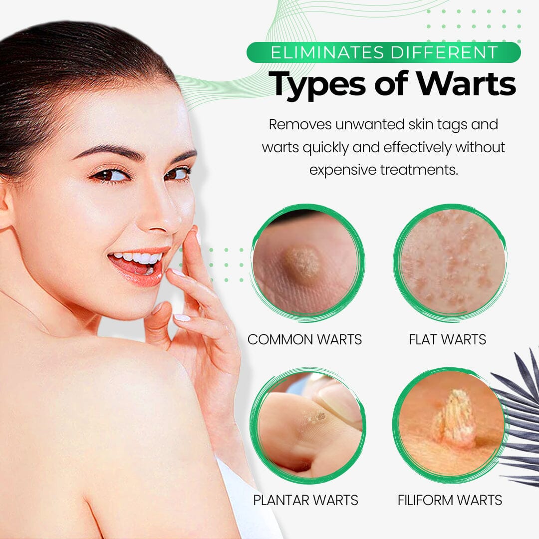 🧼SmoothSkin Wart Eliminator Soap